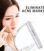 Blue Light Therapy Pen – Acne, Scar & Wrinkle Treatment Device